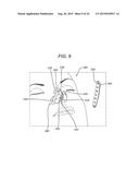 Universal Bioabsorbable Nasal Implant Kit diagram and image