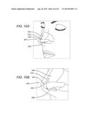 Universal Bioabsorbable Nasal Implant Kit diagram and image