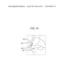 Universal Bioabsorbable Nasal Implant Kit diagram and image