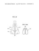 Universal Bioabsorbable Nasal Implant Kit diagram and image