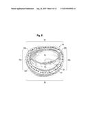 METHODS FOR REPAIR OF ABNORMAL MITRAL VALVES diagram and image