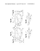 METHODS FOR REPAIR OF ABNORMAL MITRAL VALVES diagram and image