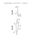 METHODS FOR REPAIR OF ABNORMAL MITRAL VALVES diagram and image