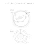 COILED ANCHOR FOR SUPPORTING PROSTHETIC HEART VALVE, PROSTHETIC HEART     VALVE, AND DEPLOYMENT DEVICE diagram and image