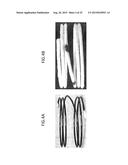 COILED ANCHOR FOR SUPPORTING PROSTHETIC HEART VALVE, PROSTHETIC HEART     VALVE, AND DEPLOYMENT DEVICE diagram and image