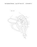 COILED ANCHOR FOR SUPPORTING PROSTHETIC HEART VALVE, PROSTHETIC HEART     VALVE, AND DEPLOYMENT DEVICE diagram and image