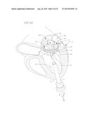 COILED ANCHOR FOR SUPPORTING PROSTHETIC HEART VALVE, PROSTHETIC HEART     VALVE, AND DEPLOYMENT DEVICE diagram and image