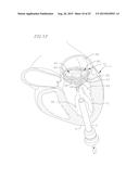 COILED ANCHOR FOR SUPPORTING PROSTHETIC HEART VALVE, PROSTHETIC HEART     VALVE, AND DEPLOYMENT DEVICE diagram and image