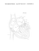 COILED ANCHOR FOR SUPPORTING PROSTHETIC HEART VALVE, PROSTHETIC HEART     VALVE, AND DEPLOYMENT DEVICE diagram and image