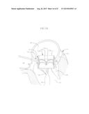 COILED ANCHOR FOR SUPPORTING PROSTHETIC HEART VALVE, PROSTHETIC HEART     VALVE, AND DEPLOYMENT DEVICE diagram and image