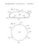 PROSTHETIC HEART VALVE, SYSTEM, AND METHOD diagram and image