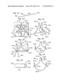 PROSTHETIC HEART VALVE, SYSTEM, AND METHOD diagram and image