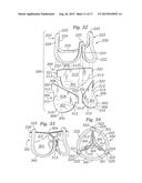 PROSTHETIC HEART VALVE, SYSTEM, AND METHOD diagram and image