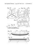 PROSTHETIC HEART VALVE, SYSTEM, AND METHOD diagram and image