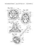 PROSTHETIC HEART VALVE, SYSTEM, AND METHOD diagram and image