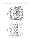 FLEXIBLE COMMISSURE FRAME diagram and image