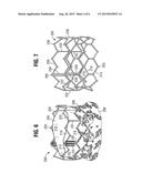 FLEXIBLE COMMISSURE FRAME diagram and image