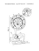 TISSUE ANCHOR FOR ANNULOPLASTY DEVICE diagram and image