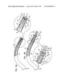 TISSUE ANCHOR FOR ANNULOPLASTY DEVICE diagram and image