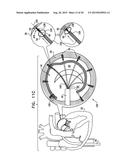 TISSUE ANCHOR FOR ANNULOPLASTY DEVICE diagram and image