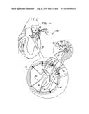 TISSUE ANCHOR FOR ANNULOPLASTY DEVICE diagram and image