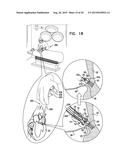 TISSUE ANCHOR FOR ANNULOPLASTY DEVICE diagram and image