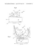 POSTERIOR STABILIZED KNEE PROSTHESIS diagram and image