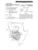 SYSTEM AND METHOD FOR IMPLATING A SECONDARY GLENOID PROSTHESIS diagram and image