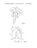 SYSTEM AND METHOD FOR IMPLATING A SECONDARY GLENOID PROSTHESIS diagram and image