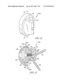 SYSTEM AND METHOD FOR IMPLATING A SECONDARY GLENOID PROSTHESIS diagram and image