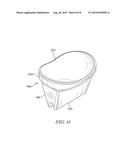 SYSTEM AND METHOD FOR IMPLATING A SECONDARY GLENOID PROSTHESIS diagram and image