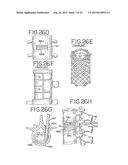 SPINAL TISSUE DISTRACTION DEVICES diagram and image