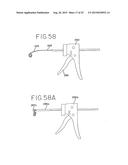 SPINAL TISSUE DISTRACTION DEVICES diagram and image