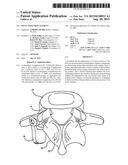 FACET JOINT REPLACEMENT diagram and image