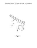 FACET JOINT REPLACEMENT diagram and image