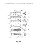 FACET JOINT REPLACEMENT diagram and image