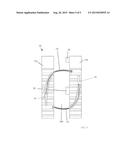 Minimally Invasive Expandable Interbody Fusion Cage diagram and image