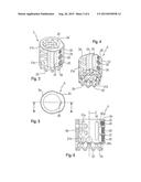 LENGTH ADJUSTABLE IMPLANT diagram and image