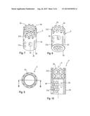 LENGTH ADJUSTABLE IMPLANT diagram and image