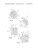 LENGTH ADJUSTABLE IMPLANT diagram and image