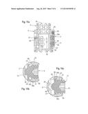 LENGTH ADJUSTABLE IMPLANT diagram and image