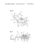 LENGTH ADJUSTABLE IMPLANT diagram and image