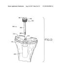 ORTHOPEDIC TOOL FOR ALTERING THE CONNECTION BETWEEN ORTHOPEDIC COMPONENTS diagram and image