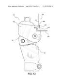 PROSTHETIC KNEE diagram and image