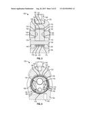 PROSTHETIC JOINT WITH CAM LOCKING MECHANISM diagram and image