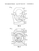 PROSTHETIC JOINT WITH CAM LOCKING MECHANISM diagram and image