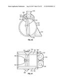 PROSTHETIC JOINT WITH CAM LOCKING MECHANISM diagram and image