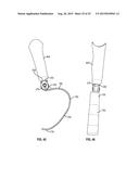 PROSTHETIC JOINT WITH CAM LOCKING MECHANISM diagram and image