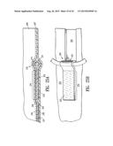 ENDOVASCULAR GRAFT JOINT AND METHOD FOR MANUFACTURE diagram and image