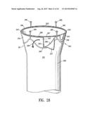 ENDOVASCULAR GRAFT JOINT AND METHOD FOR MANUFACTURE diagram and image